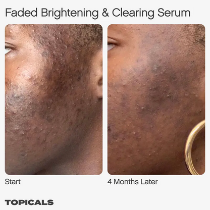 Faded Serum - For Dark Spots + Discoloration
