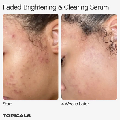 Faded Serum - For Dark Spots + Discoloration