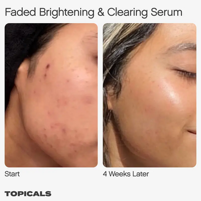 Faded Serum - For Dark Spots + Discoloration