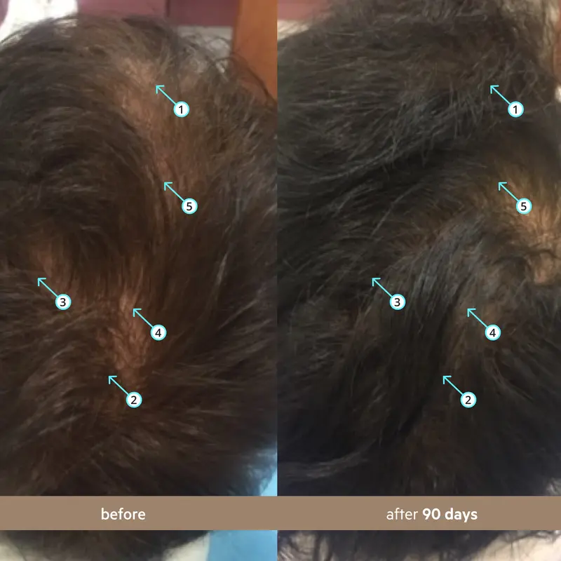 Spectral Men's (Spectral.DNC-N) | Hair Density Serum with Nanoxidil 5%
