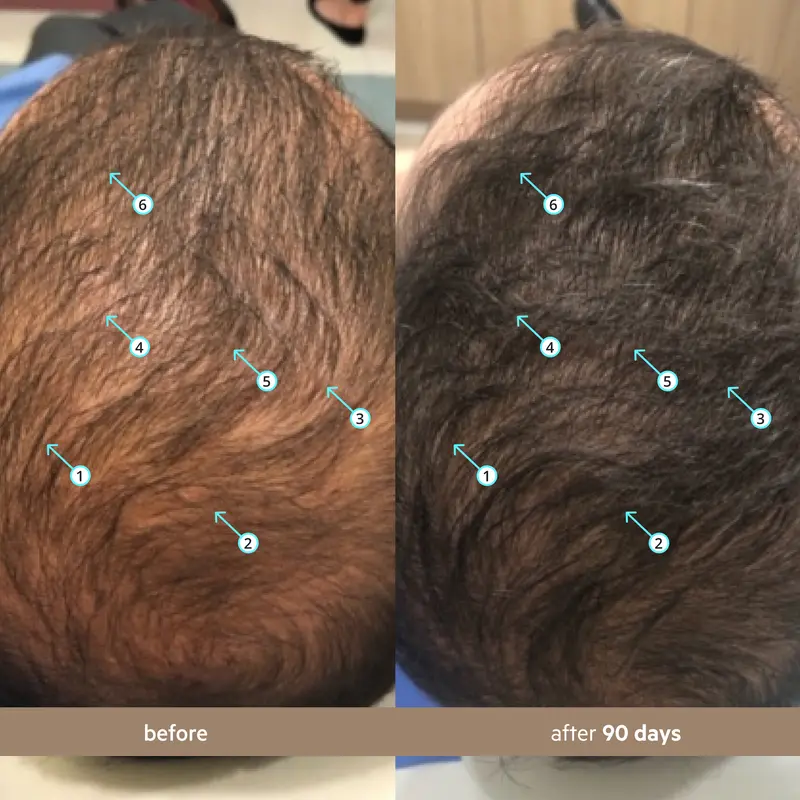 Spectral Men's (Spectral.DNC-N) | Hair Density Serum with Nanoxidil 5%