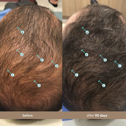 Spectral Men's (Spectral.DNC-N) | Hair Density Serum with Nanoxidil 5%