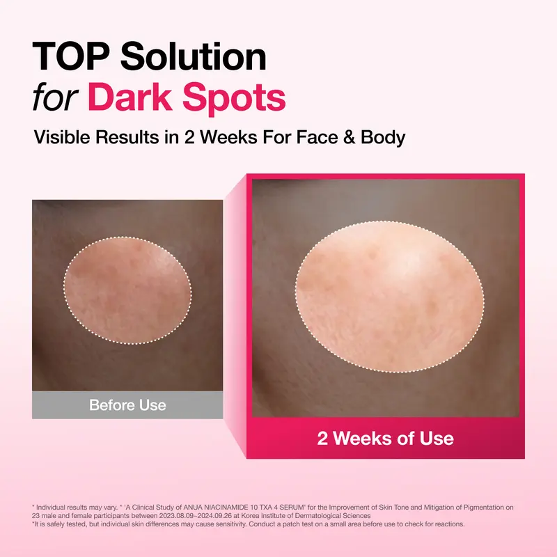 Dark Spot Correcting Serum : 10% Niacinamide+ 4% Tranexamic Acid 1.01 fl.oz. (30ml) ｜ Niacinamide Serum, PM Skincare product, Hyperpigmentation, Brightening